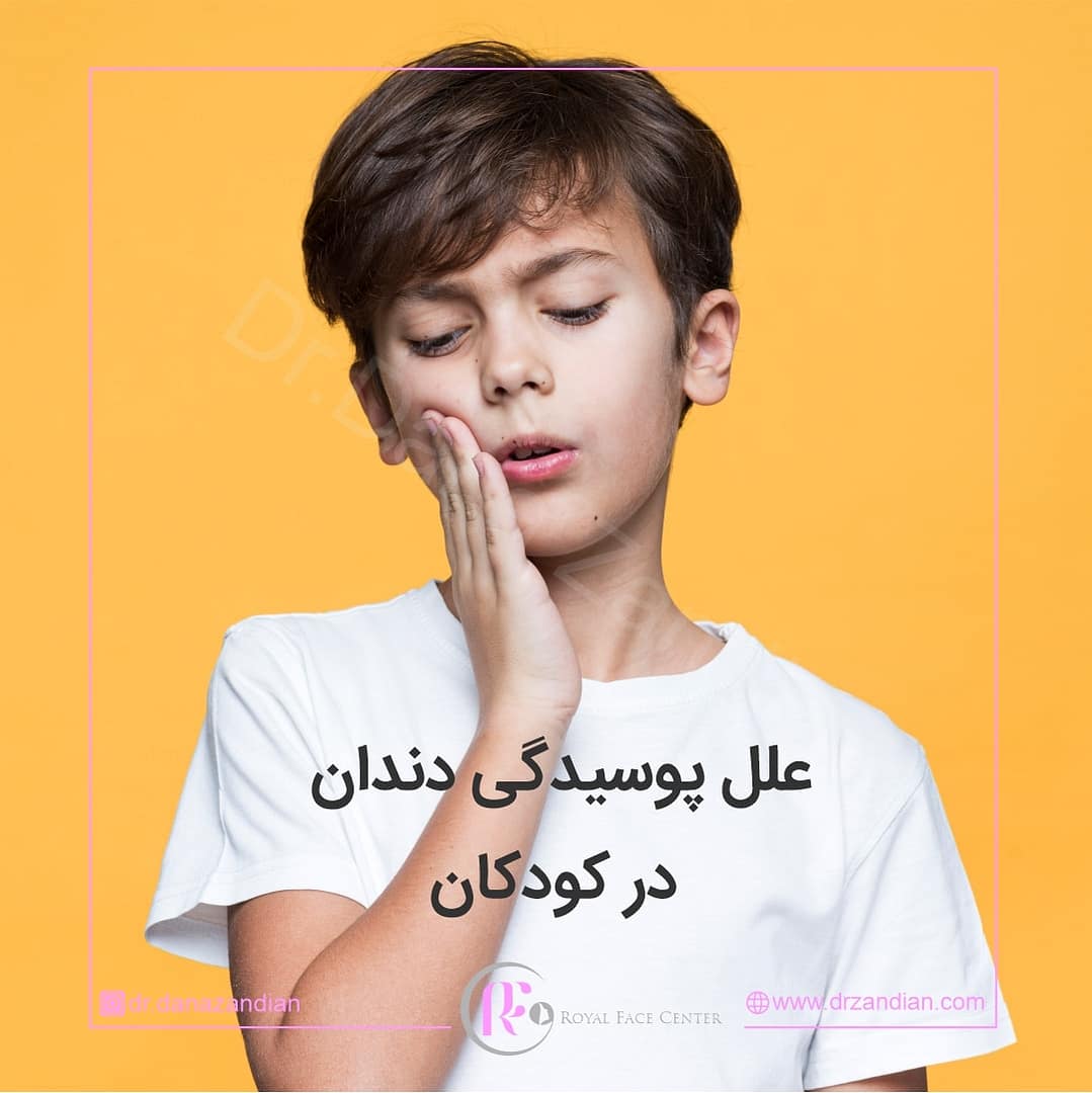 علل پوسیدگی دندان کودکان