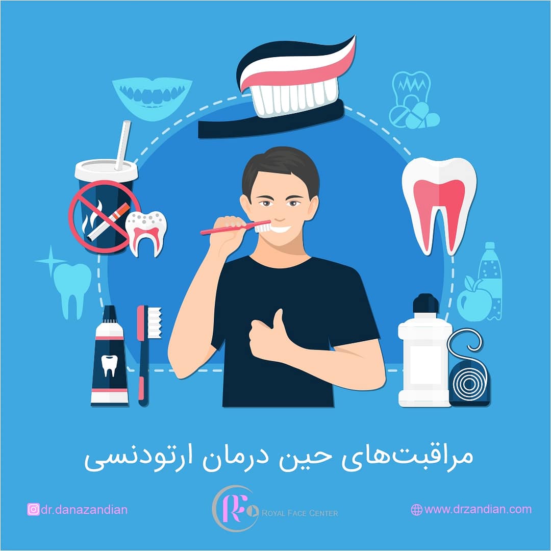 مراقبت های حین ارتودنسی