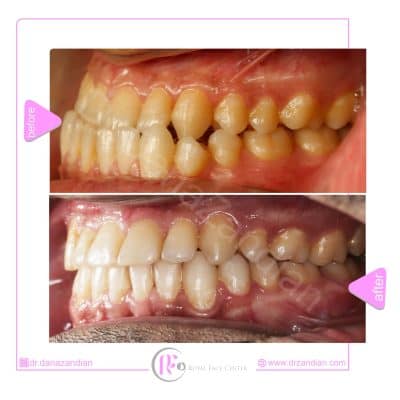 قبل و بعد از درمان ارتوسرجری