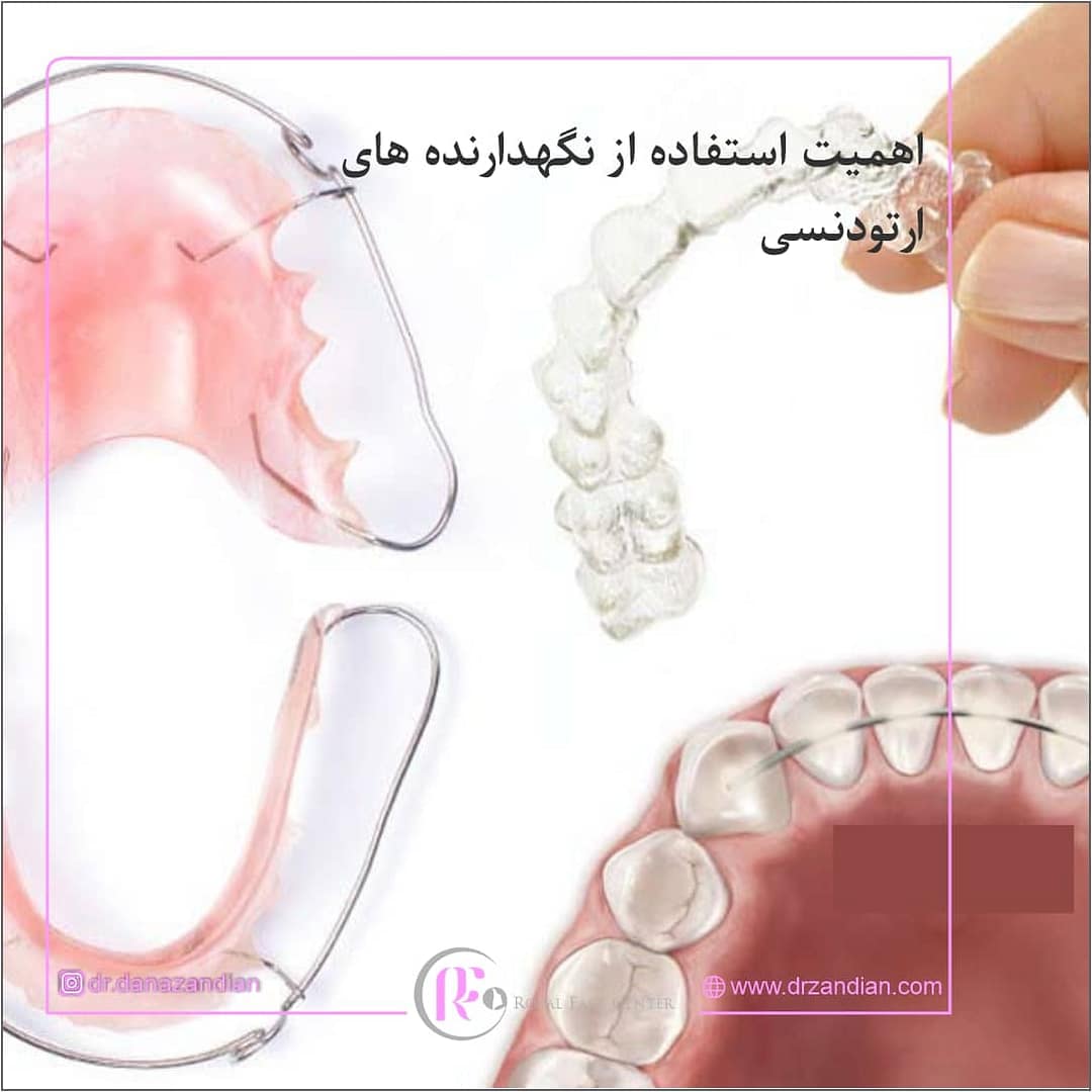 اهمیت استفاده از نگهدارنده ارتودنسی