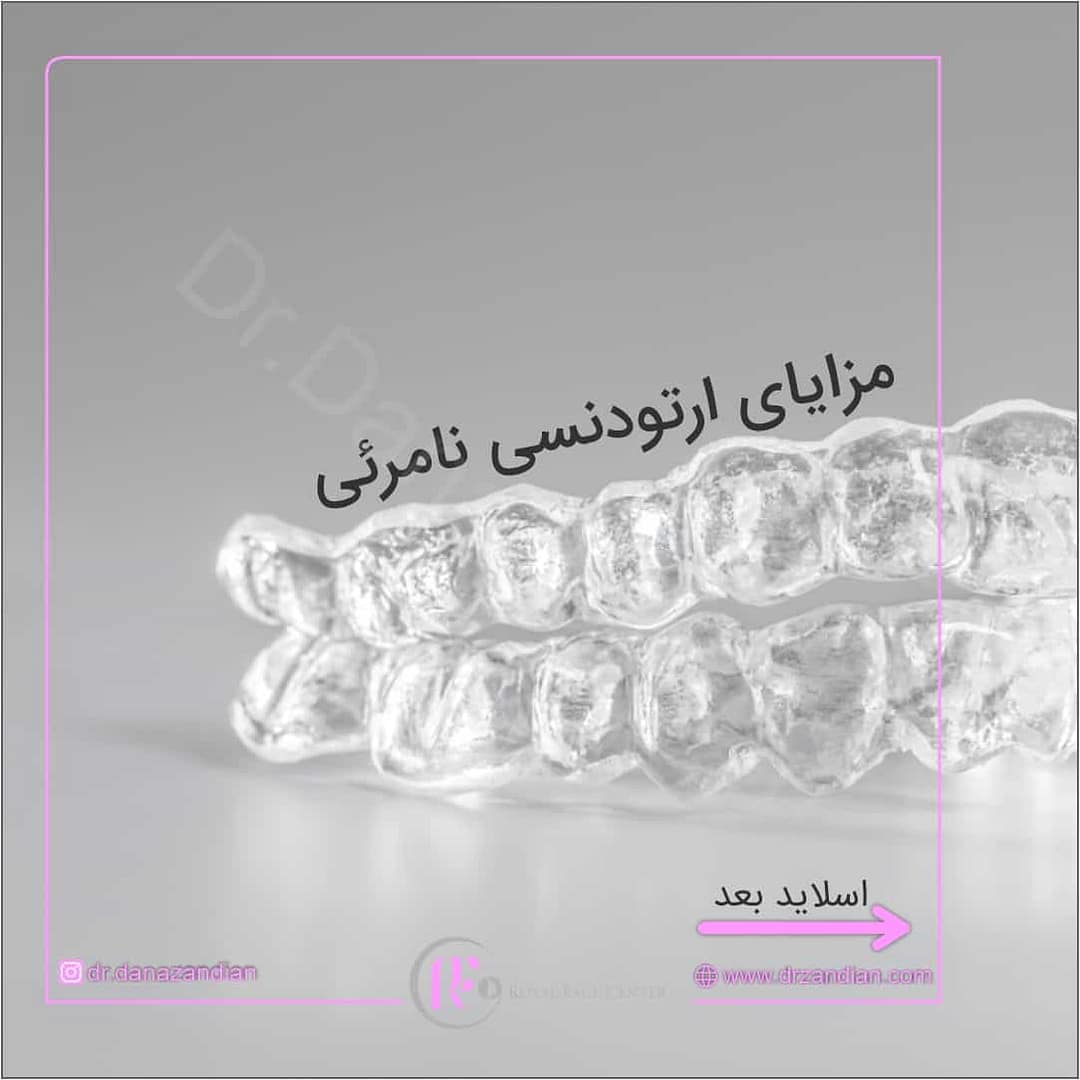 مزایای ارتودنسی نامرئی