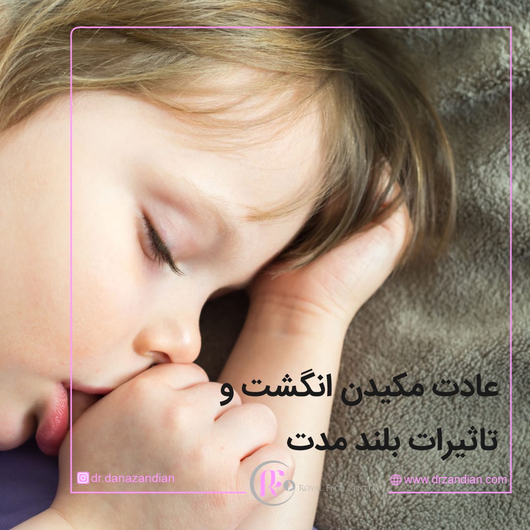 مکیدن انگشت