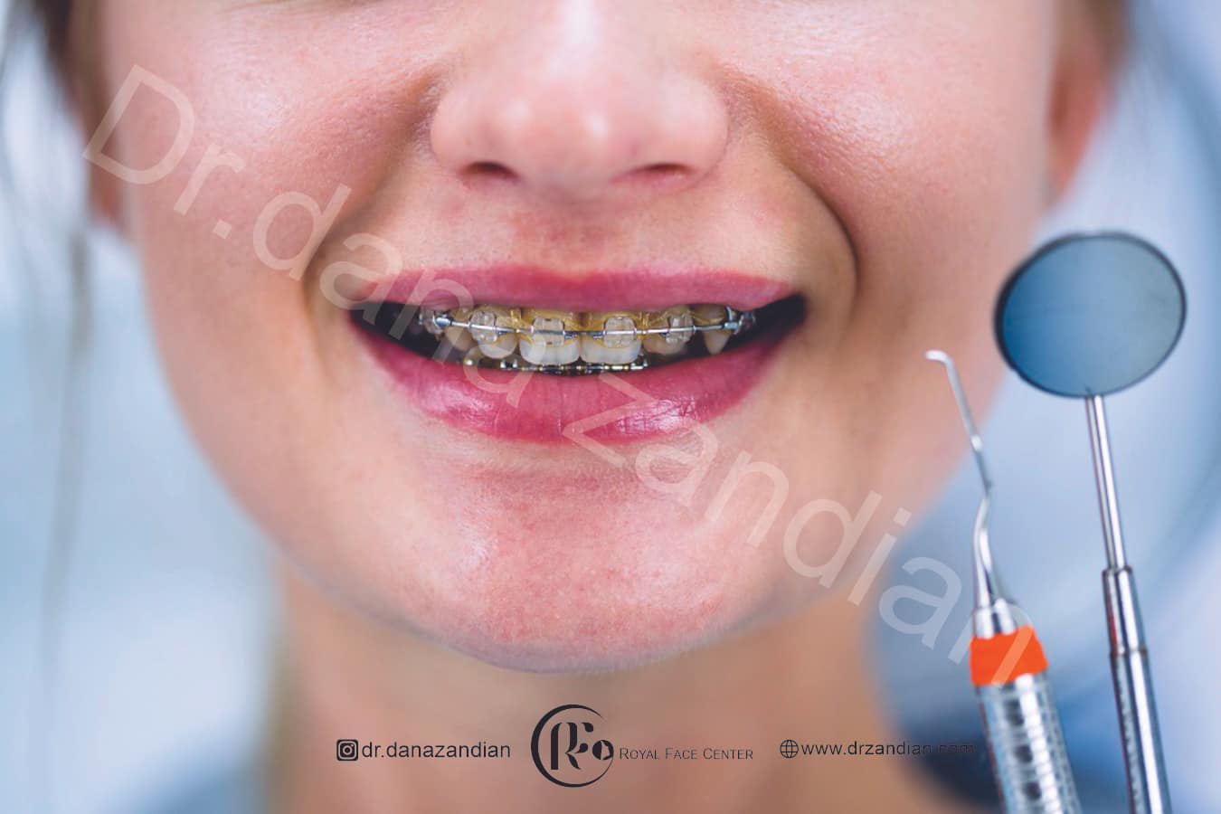 ارتودنسی بزرگسالان