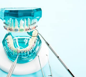 نمونه ارتودنسی