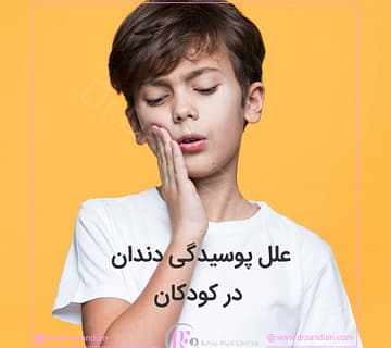 علل پوسیدگی دندان کودکان