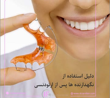 دلیل استفاده از نگهدارنده ها پس از ارتودنسی