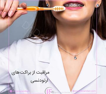 مراقبت از براکت های ارتودنسی