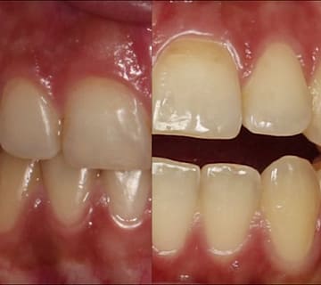 ارتودنسی ثابت