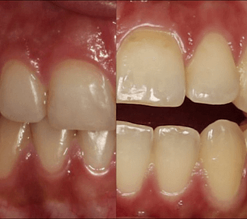 ارتودنسی ثابت