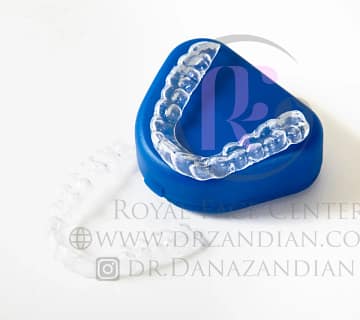 نگهدارنده ارتودنسی