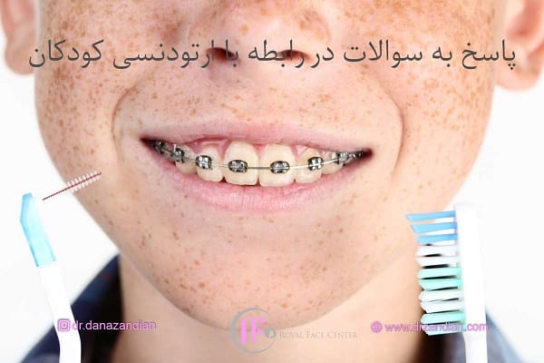 ارتودنسی کودکان